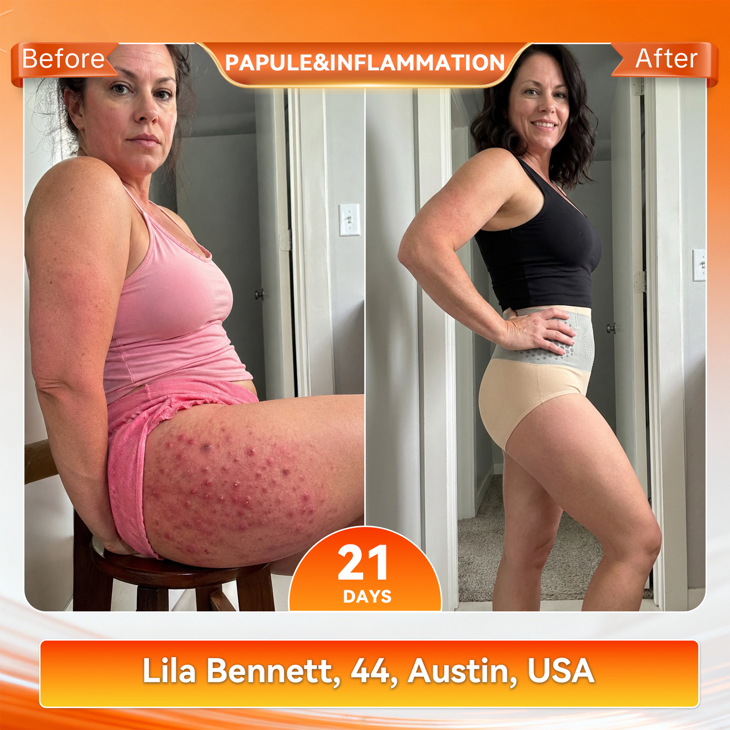 𝐎𝐟𝐟𝐢𝐜𝐢𝐚𝐥 𝐁𝐫𝐚𝐧𝐝 𝐒𝐭𝐨𝐫𝐞 🥇 𝐏𝐀𝐔𝐑𝐀𝐉𝐔® 𝟐𝟎𝟐𝟔 𝐌𝐨𝐫𝐢𝐧𝐠𝐚 & 𝐁𝐞𝐫𝐛𝐞𝐫𝐢𝐧𝐞 𝟒-𝐈𝐧-𝟏 𝐌𝐢𝐜𝐫𝐨-𝐏𝐚𝐫𝐭𝐢𝐜𝐥𝐞 𝐒𝐜𝐮𝐥𝐩𝐭𝐢𝐧𝐠 & 𝐅𝐚𝐭-𝐁𝐮𝐫𝐧 𝐒𝐡𝐨𝐫𝐭𝐬🔥