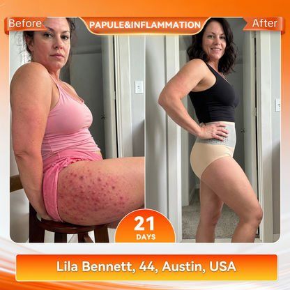 𝐎𝐟𝐟𝐢𝐜𝐢𝐚𝐥 𝐁𝐫𝐚𝐧𝐝 𝐒𝐭𝐨𝐫𝐞 🥇 𝐏𝐀𝐔𝐑𝐀𝐉𝐔® 𝟐𝟎𝟐𝟔 𝐌𝐨𝐫𝐢𝐧𝐠𝐚 & 𝐁𝐞𝐫𝐛𝐞𝐫𝐢𝐧𝐞 𝟒-𝐈𝐧-𝟏 𝐌𝐢𝐜𝐫𝐨-𝐏𝐚𝐫𝐭𝐢𝐜𝐥𝐞 𝐒𝐜𝐮𝐥𝐩𝐭𝐢𝐧𝐠 & 𝐅𝐚𝐭-𝐁𝐮𝐫𝐧 𝐒𝐡𝐨𝐫𝐭𝐬🔥