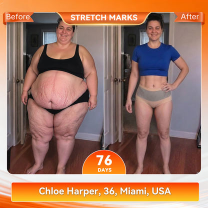 𝐎𝐟𝐟𝐢𝐜𝐢𝐚𝐥 𝐁𝐫𝐚𝐧𝐝 𝐒𝐭𝐨𝐫𝐞 🥇 𝐏𝐀𝐔𝐑𝐀𝐉𝐔® 𝟐𝟎𝟐𝟔 𝐌𝐨𝐫𝐢𝐧𝐠𝐚 & 𝐁𝐞𝐫𝐛𝐞𝐫𝐢𝐧𝐞 𝟒-𝐈𝐧-𝟏 𝐌𝐢𝐜𝐫𝐨-𝐏𝐚𝐫𝐭𝐢𝐜𝐥𝐞 𝐒𝐜𝐮𝐥𝐩𝐭𝐢𝐧𝐠 & 𝐅𝐚𝐭-𝐁𝐮𝐫𝐧 𝐒𝐡𝐨𝐫𝐭𝐬🔥