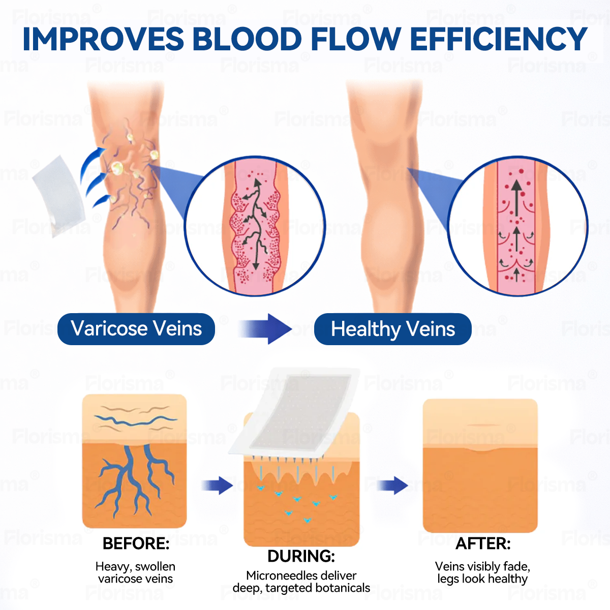 One Patch a Day. Visible Vein Relief in Just 7 Days 👨‍⚕️ 𝑭𝑳𝑶𝑹𝑰𝑺𝑴𝑨® 𝑫𝑰𝑶𝑺𝑴𝑰𝑵 & 𝑯𝑬𝑺𝑷𝑬𝑹𝑰𝑫𝑰𝑵 𝑪𝒍𝒊𝒏𝒊𝒄𝒂𝒍-𝑮𝒓𝒂𝒅𝒆 𝑭𝒐𝒓𝒎𝒖𝒍𝒂 𝑴𝒊𝒄𝒓𝒐𝒏𝒆𝒆𝒅𝒍𝒆 𝑷𝒂𝒕𝒄𝒉 ⚡ 𝗔𝗱𝘃𝗮𝗻𝗰𝗲𝗱 𝗛𝗲𝗿𝗯𝗮𝗹 𝗕𝗹𝗲𝗻𝗱 𝗧𝗮𝗿𝗴𝗲𝘁𝘀 𝗦𝗽𝗶𝗱𝗲𝗿 𝗩𝗲𝗶𝗻𝘀 & 𝗥𝗲𝗹𝗶𝗲𝘃𝗲𝘀 𝗛𝗲𝗮𝘃𝘆, 𝗧𝗶𝗿𝗲𝗱 𝗟𝗲𝗴𝘀