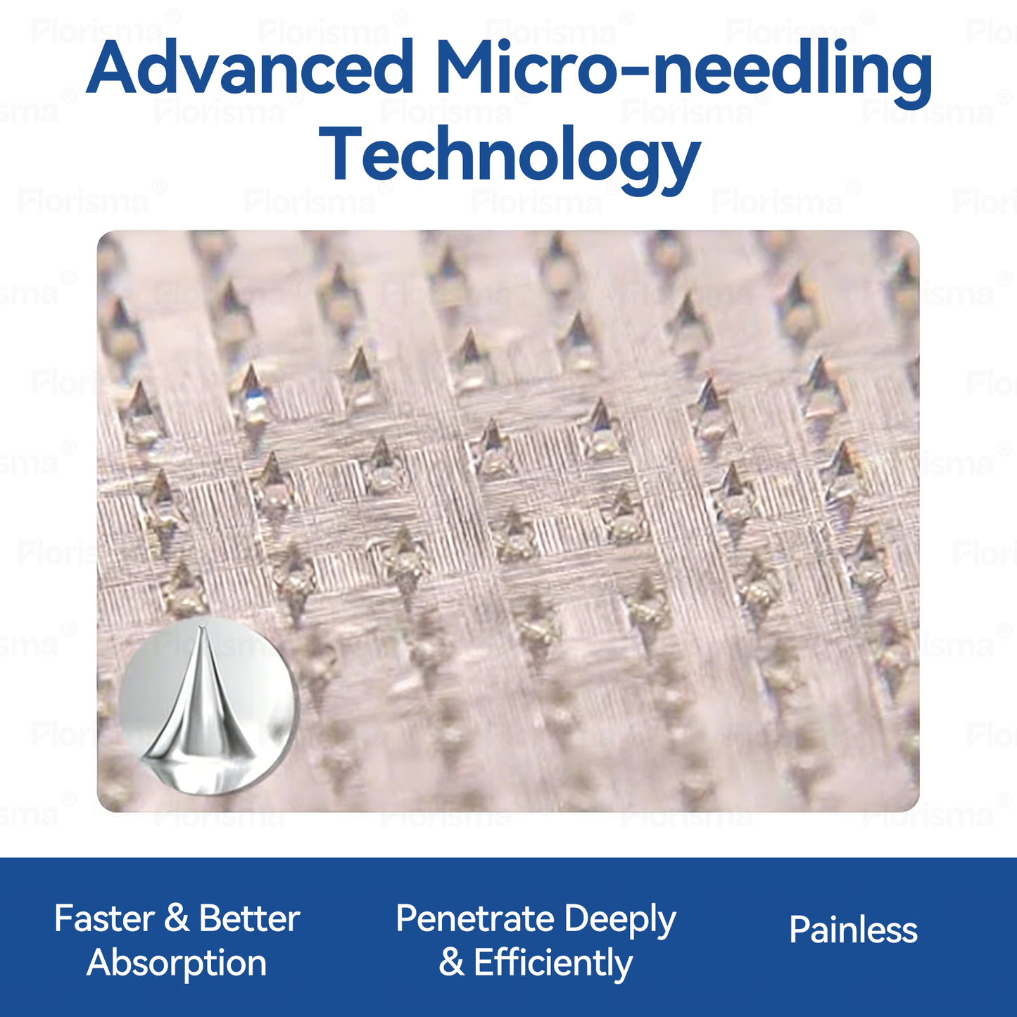 One Patch a Day. Visible Vein Relief in Just 7 Days 👨‍⚕️ 𝑭𝑳𝑶𝑹𝑰𝑺𝑴𝑨® 𝑫𝑰𝑶𝑺𝑴𝑰𝑵 & 𝑯𝑬𝑺𝑷𝑬𝑹𝑰𝑫𝑰𝑵 𝑪𝒍𝒊𝒏𝒊𝒄𝒂𝒍-𝑮𝒓𝒂𝒅𝒆 𝑭𝒐𝒓𝒎𝒖𝒍𝒂 𝑴𝒊𝒄𝒓𝒐𝒏𝒆𝒆𝒅𝒍𝒆 𝑷𝒂𝒕𝒄𝒉 🌿 𝗔𝗱𝘃𝗮𝗻𝗰𝗲𝗱 𝗛𝗲𝗿𝗯𝗮𝗹 𝗕𝗹𝗲𝗻𝗱 𝗧𝗮𝗿𝗴𝗲𝘁𝘀 𝗦𝗽𝗶𝗱𝗲𝗿 𝗩𝗲𝗶𝗻𝘀 & 𝗥𝗲𝗹𝗶𝗲𝘃𝗲𝘀 𝗛𝗲𝗮𝘃𝘆, 𝗧𝗶𝗿𝗲𝗱 𝗟𝗲𝗴𝘀