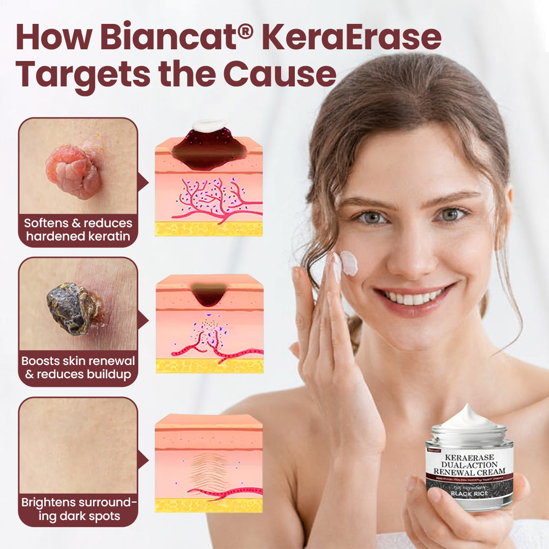 💕DORMORNA® KeraErase Dual-Action Renewal Cream