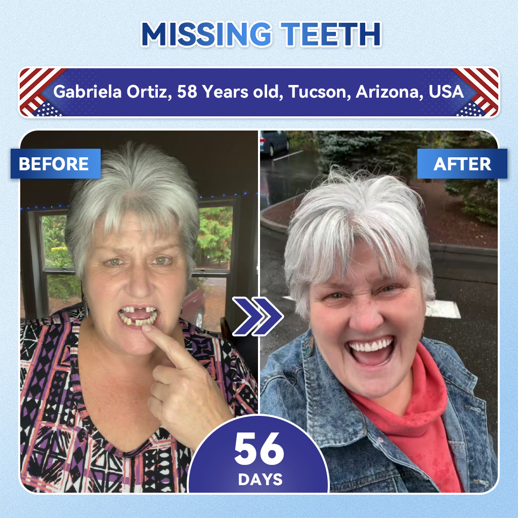 Glimmerly® 🦷 Tideglusib Fast‑Dissolving Tooth & Gum Repair Oral Strips 💖 (Supports tooth repair and helps relieve gum discomfort and other common oral concerns)