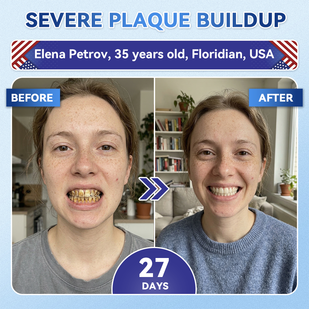 Glimmerly® 🦷 Tideglusib Fast‑Dissolving Tooth & Gum Repair Oral Strips 💖 (Supports tooth repair and helps relieve gum discomfort and other common oral concerns)