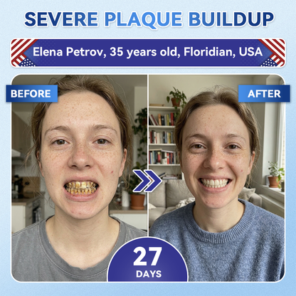 Glimmerly® 🦷 Tideglusib Fast‑Dissolving Tooth & Gum Repair Oral Strips 💖 (Supports tooth repair and helps relieve gum discomfort and other common oral concerns)