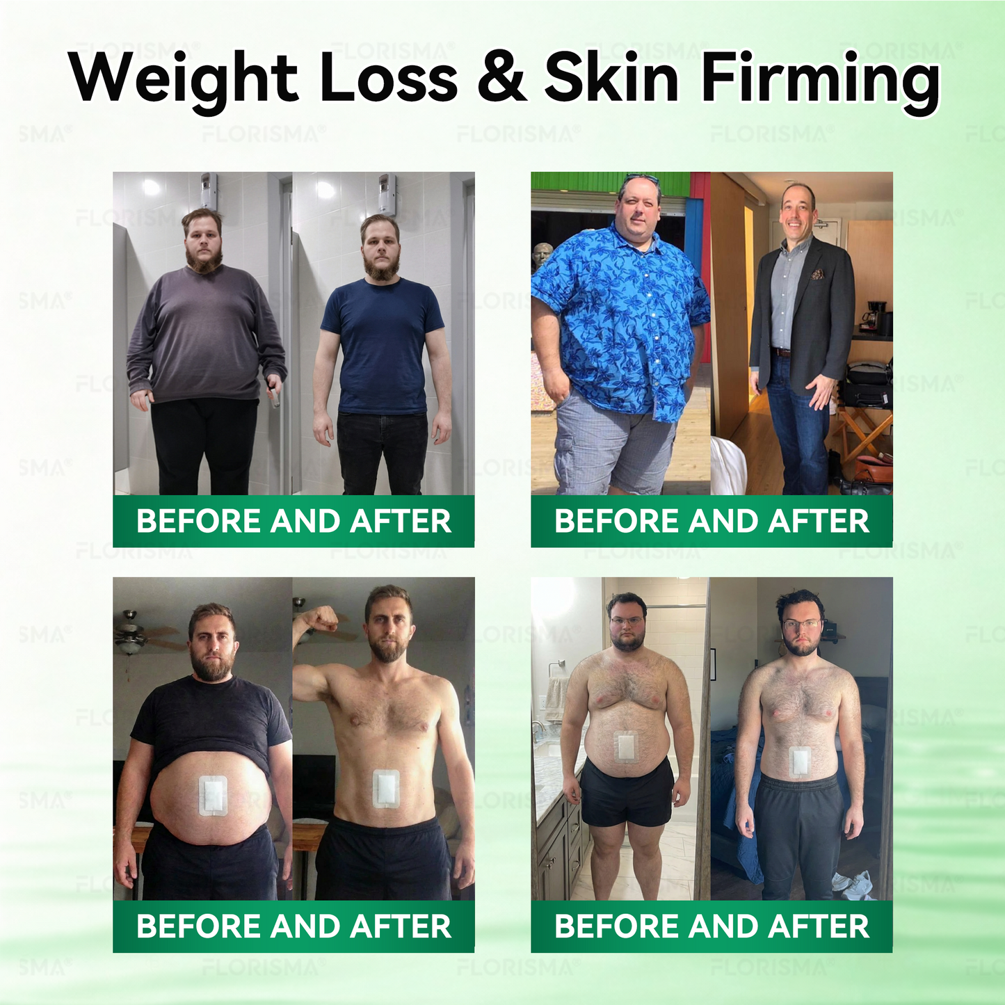 Once Daily, Visible Changes in 7 Days 👨‍🔬 𝐹𝑙𝑜𝑟𝑖𝑠𝑚𝑎® 𝐵𝑟𝑜𝑤𝑛 𝐹𝑎𝑡 𝑇𝑎𝑟𝑔𝑒𝑡𝑒𝑑 𝐹𝑎𝑡-𝐵𝑢𝑟𝑛𝑖𝑛𝑔 𝑃𝑎𝑡𝑐ℎ 🏆 Addresses obesity, diabetes, sleep apnea, lymphatic detoxification, and joint issues.