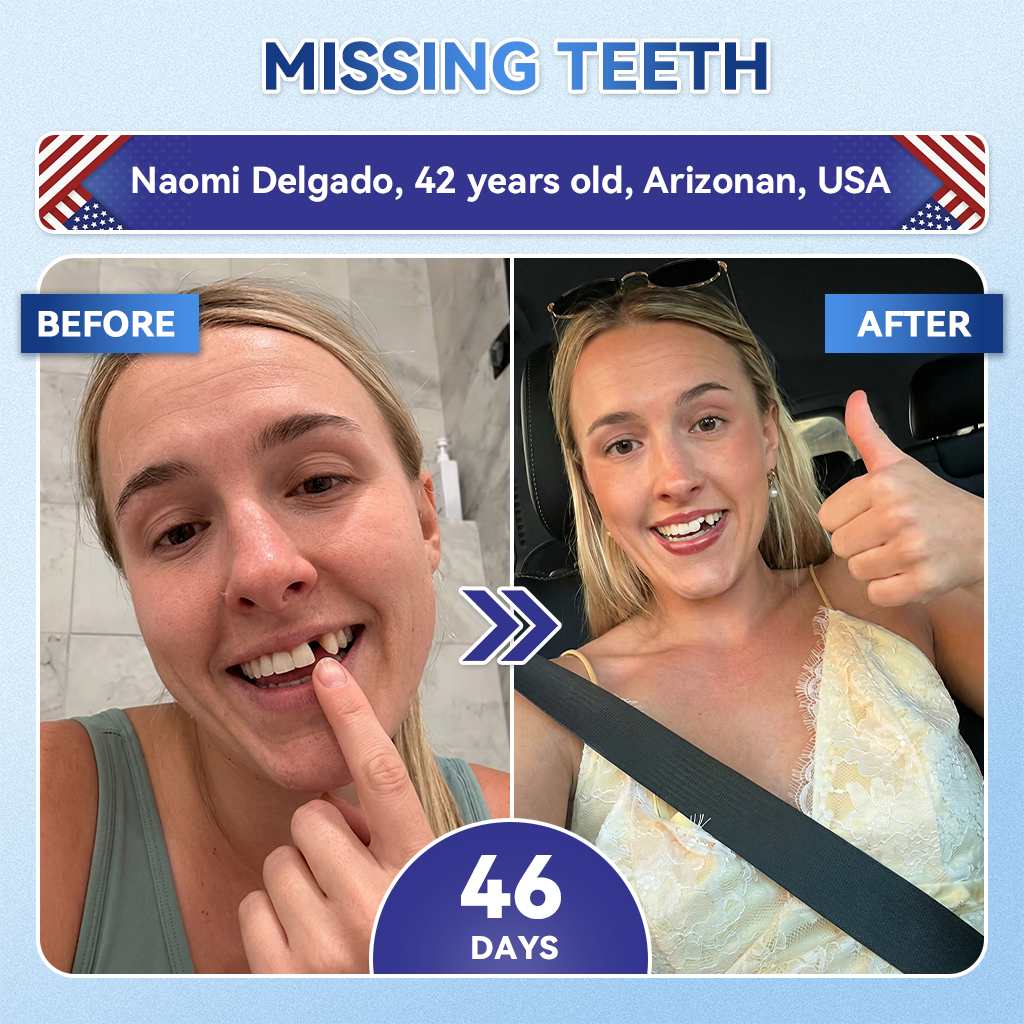 Glimmerly® 🦷 Tideglusib Fast‑Dissolving Tooth & Gum Repair Oral Strips 💖 (Supports tooth repair and helps relieve gum discomfort and other common oral concerns)