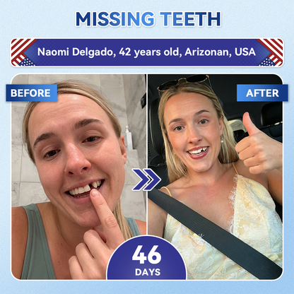 Glimmerly® 🦷 Tideglusib Fast‑Dissolving Tooth & Gum Repair Oral Strips 💖 (Supports tooth repair and helps relieve gum discomfort and other common oral concerns)