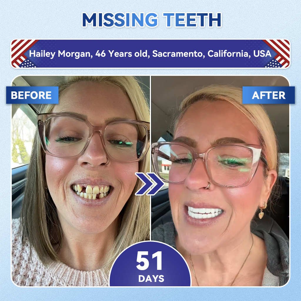 Glimmerly® 🦷 Tideglusib Fast‑Dissolving Tooth & Gum Repair Oral Strips 💖 (Supports tooth repair and helps relieve gum discomfort and other common oral concerns)