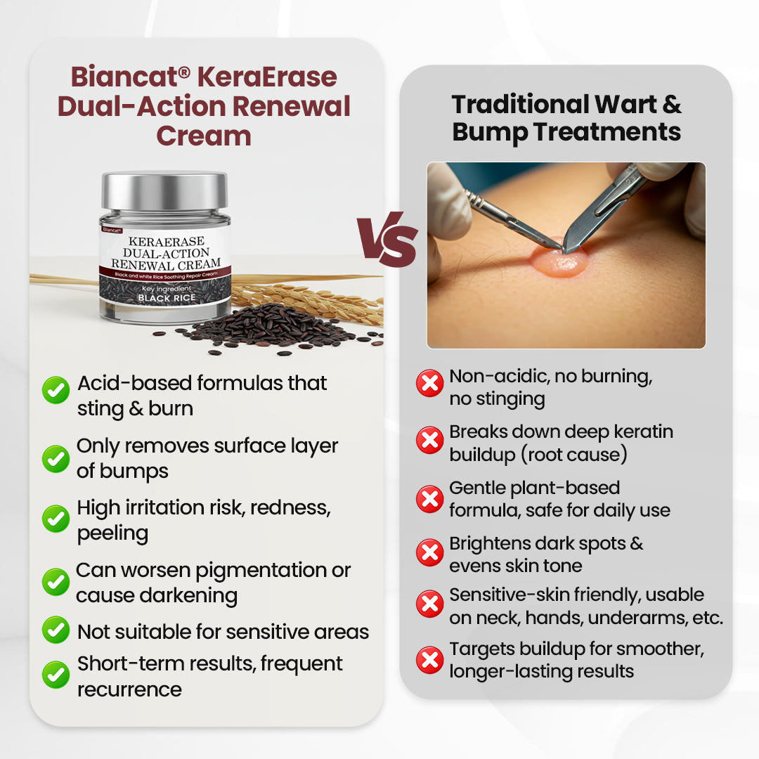 💕DORMORNA® KeraErase Dual-Action Renewal Cream